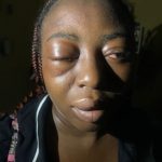 Woman robbed and battered by four men in Lagos